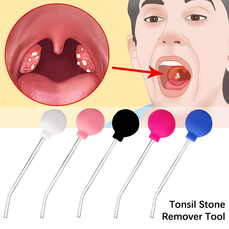 Ear Wax Remover - Strumento per la rimozione della pietra