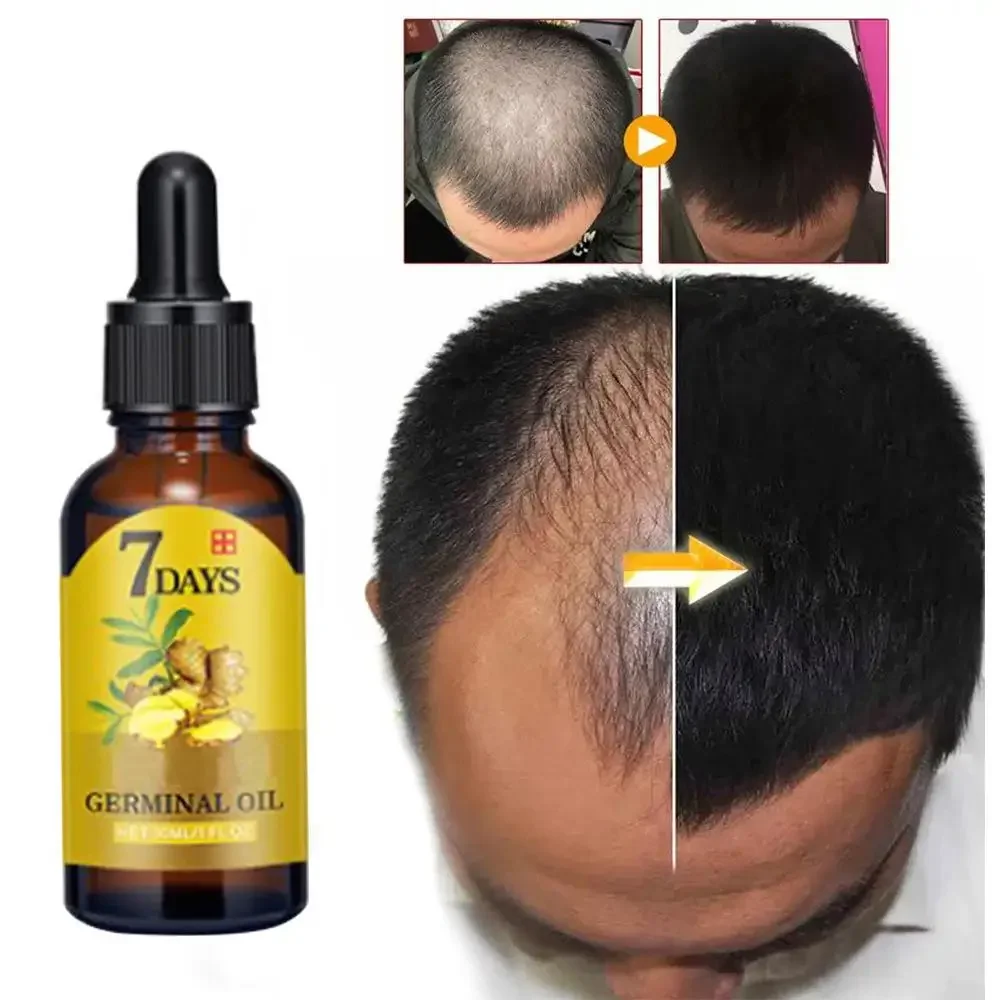 Ingrown Hair Serum - Crescita dei capelli Zenzero Capelli a