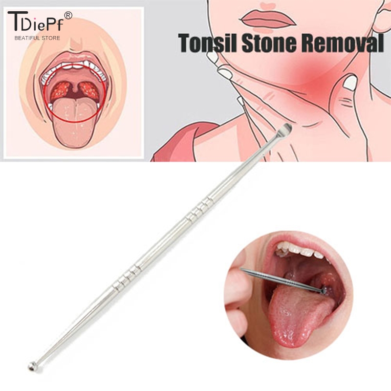 1Pc rimozione della pietra del - Ear Wax Remover recensione e prezzo