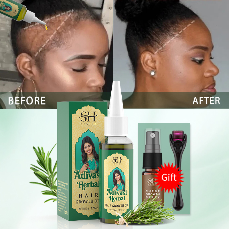 Olio Ayurvedico per la Crescit - Ingrown Hair Serum recensione e prezzo