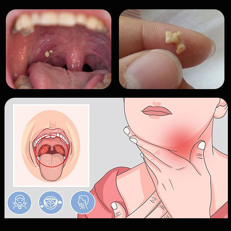Strumento per la rimozione di  - Ear Wax Remover recensione e prezzo