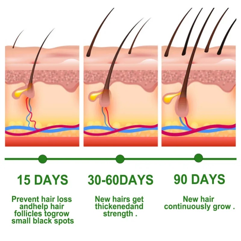 Siero per la crescita dei cape - Ingrown Hair Serum recensione e prezzo