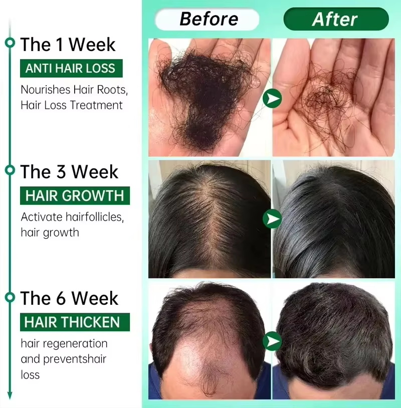 Siero per la crescita dei cape - Ingrown Hair Serum recensione e prezzo