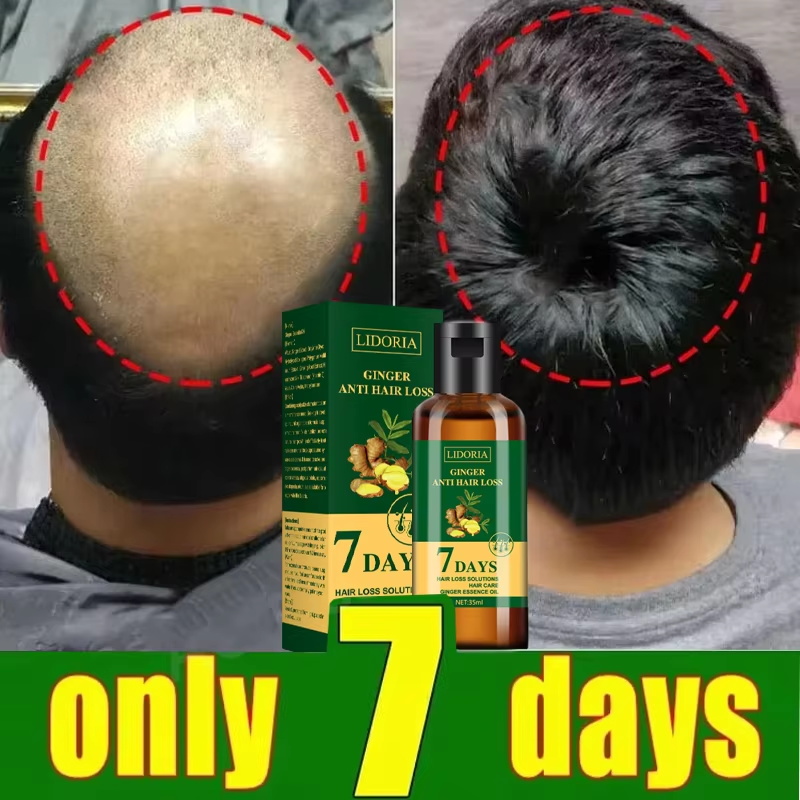Siero per la crescita dei cape - Ingrown Hair Serum recensione e prezzo