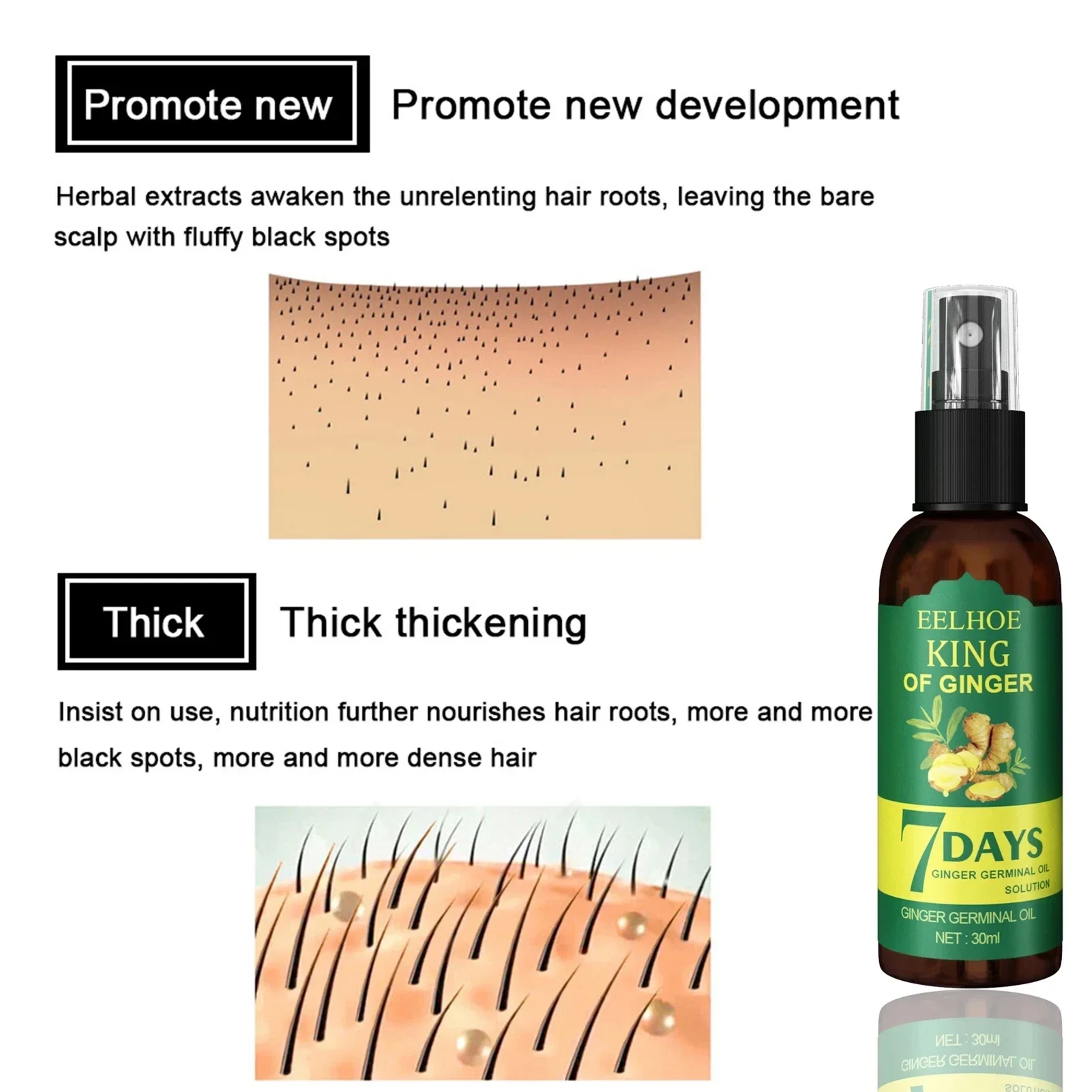 2024 Ginger Hair Growth Serum  - Ingrown Hair Serum recensione e prezzo