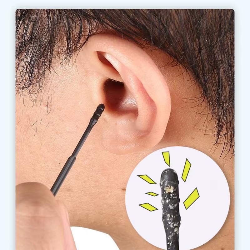 Bastone da scavo per orecchie  - Ear Wax Remover recensione e prezzo